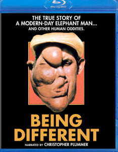Being Different (blu-ray)